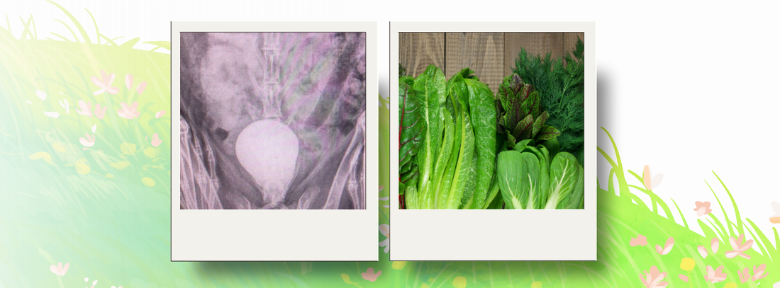 The lower calcium diet