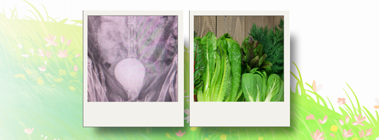 The lower calcium diet